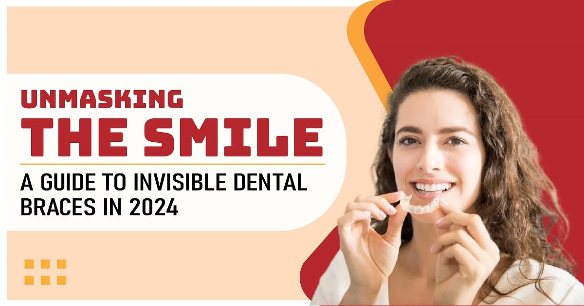 Unmasking the Smile: a Guide to Invisible Dental Braces in 2024