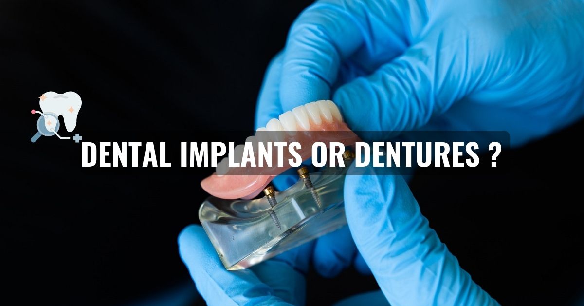Dental Implants or Dentures?