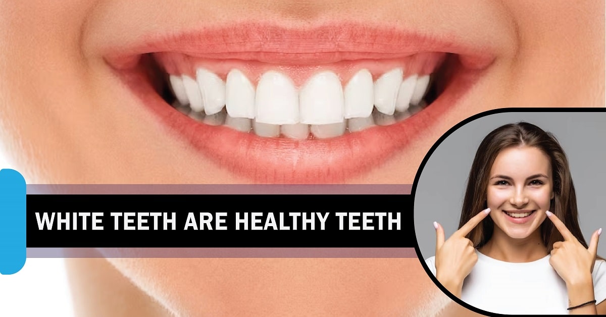 Myth: White Teeth Are Healthy Teeth