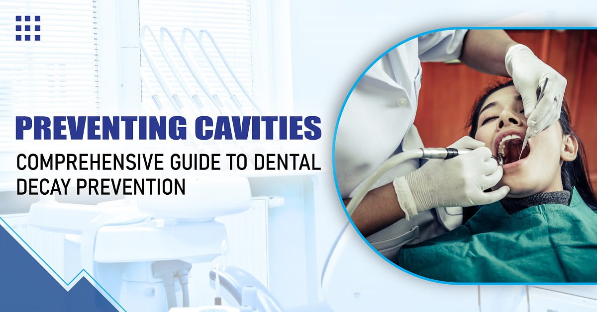 Preventing Cavities: Comprehensive Guide to Dental Decay Prevention