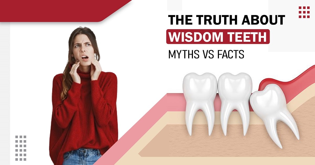 The Truth About Wisdom Teeth: Myths Vs. Facts