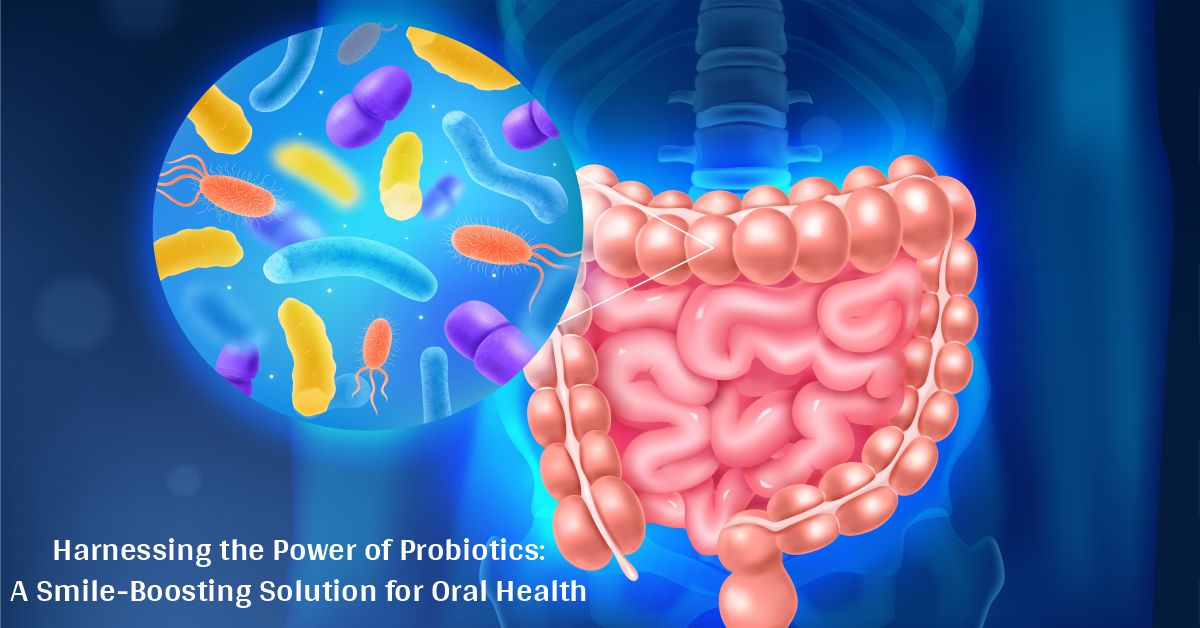 Harnessing the Power of Probiotics: a Smile-boosting Solution for Oral Health