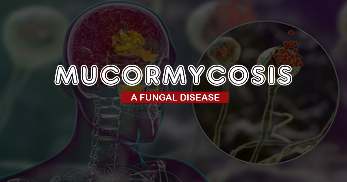 Mucormycosis: a Fungal Disease