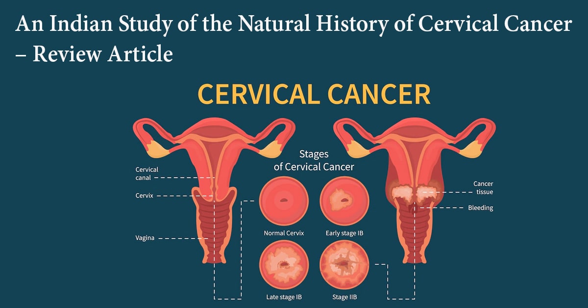 An Indian Study of the Natural History of Cervical Cancer–Review Article