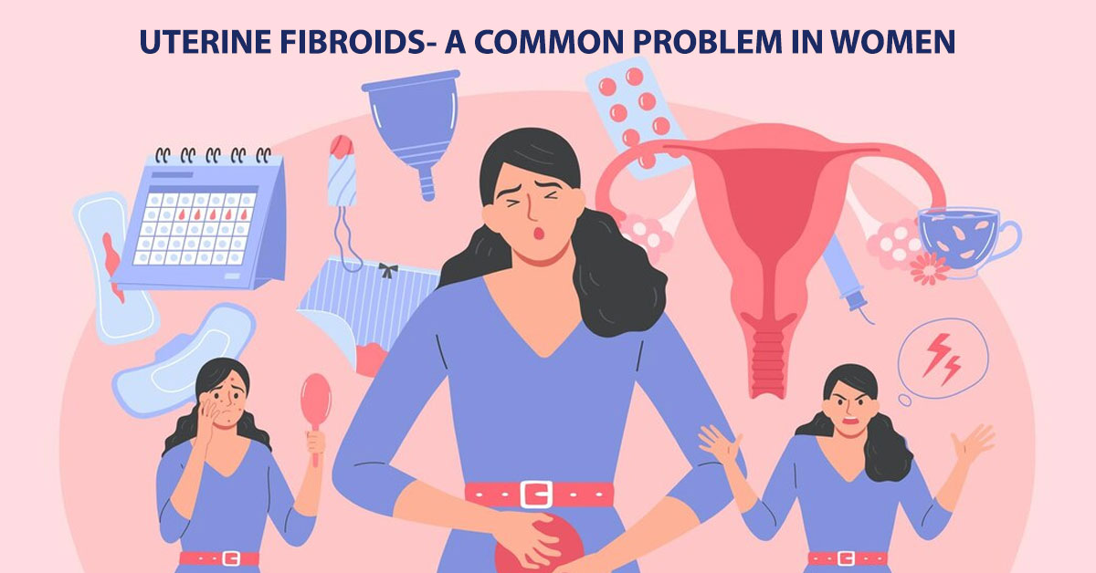 Uterine Fibroids - a Common Problem in Women