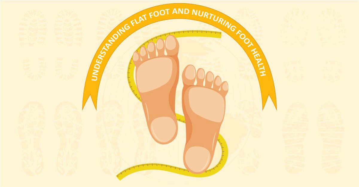 Caring for Your Arches: Understanding Flat Foot and Nurturing Foot Health