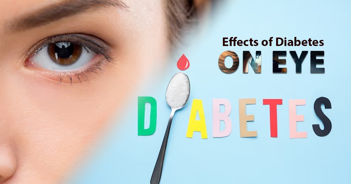 Effects of Diabetes on Eye