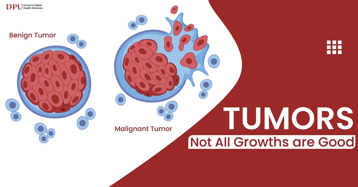 Tumors: Not All Growths Are Good