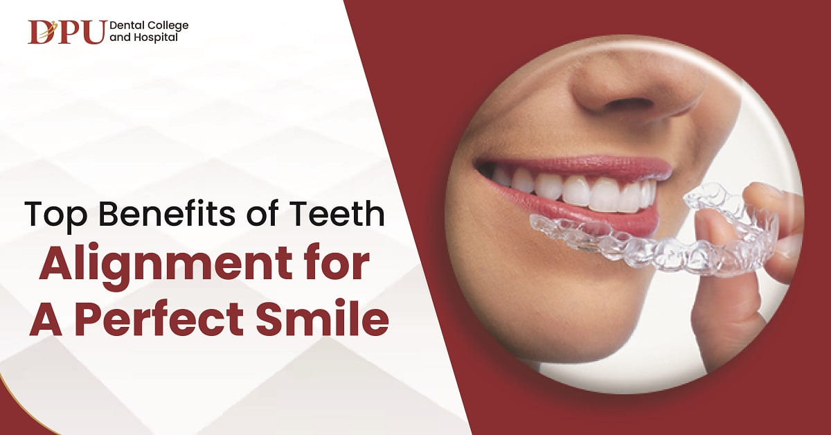 Top Benefits of Teeth Alignment for a Perfect Smile