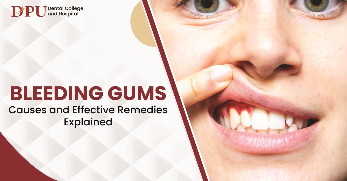 Bleeding Gums: Causes and Effective Remedies Explained