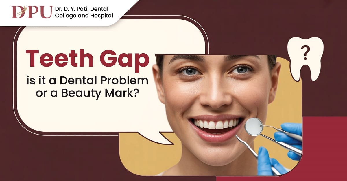 Teeth Gap: Is It a Dental Problem or a Beauty Mark?