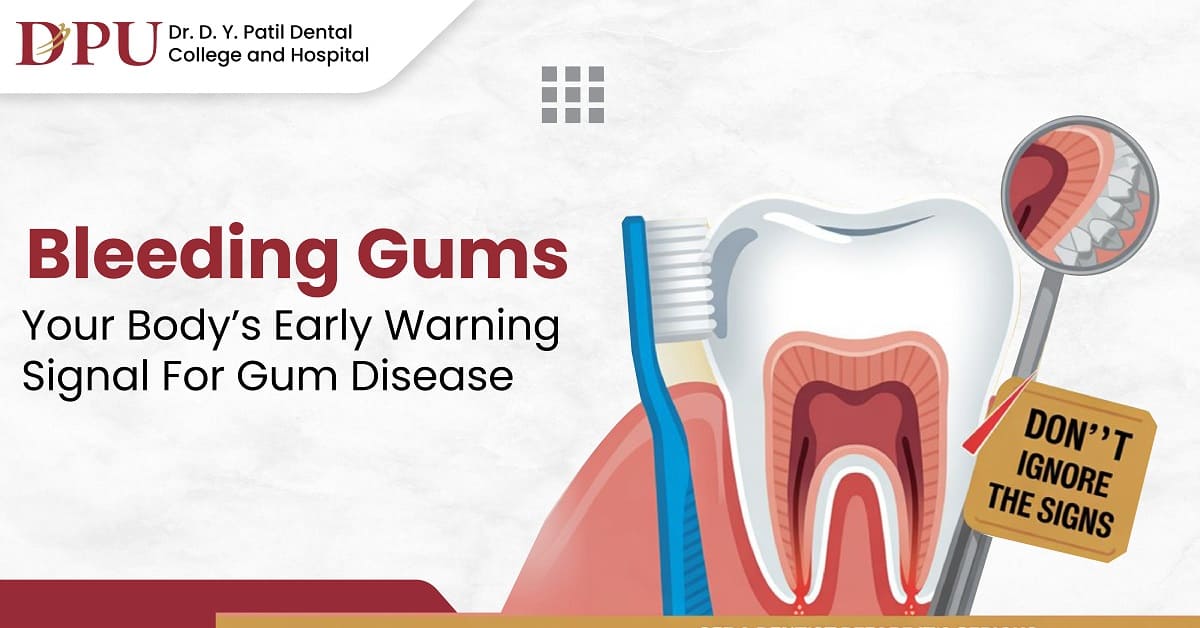 Bleeding Gums: Early Warning Sign of Gum Disease?