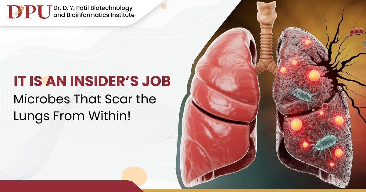 It is an Insider’s Job Microbes That Scar the Lungs from Within!