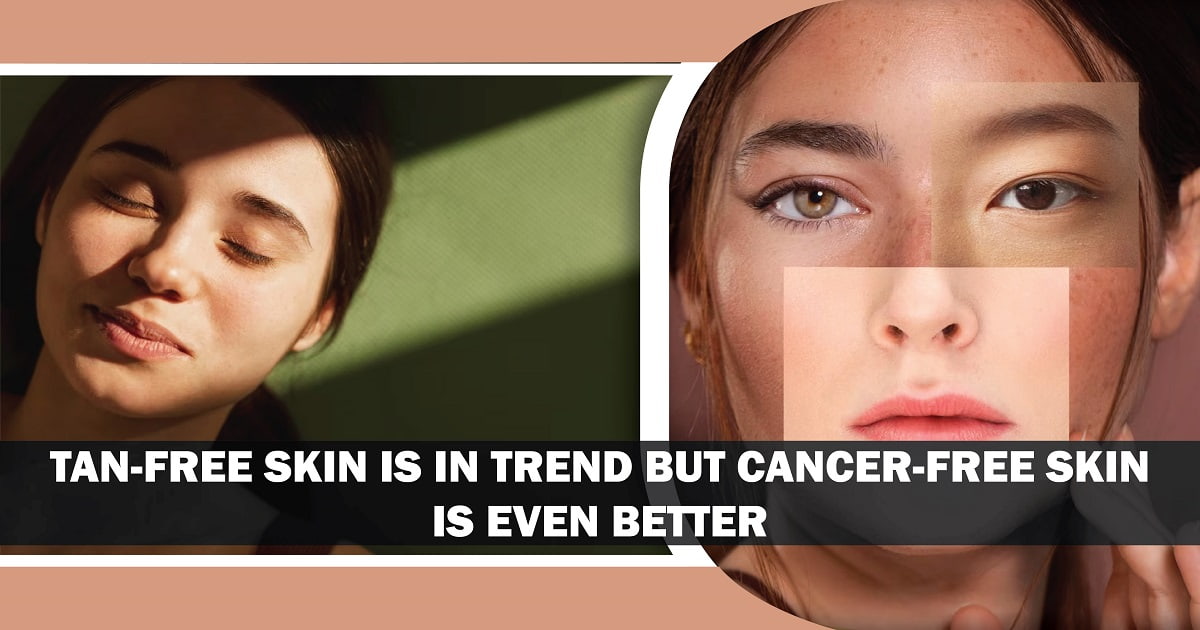 Tan-free Skin is in Trend but Cancer-free Skin is Even Better