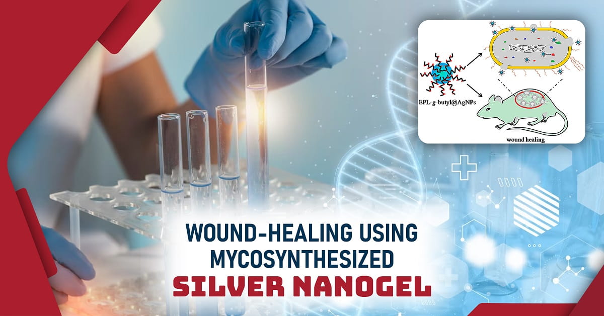 Wound-Healing Using Mycosynthesized Silver Nanogel