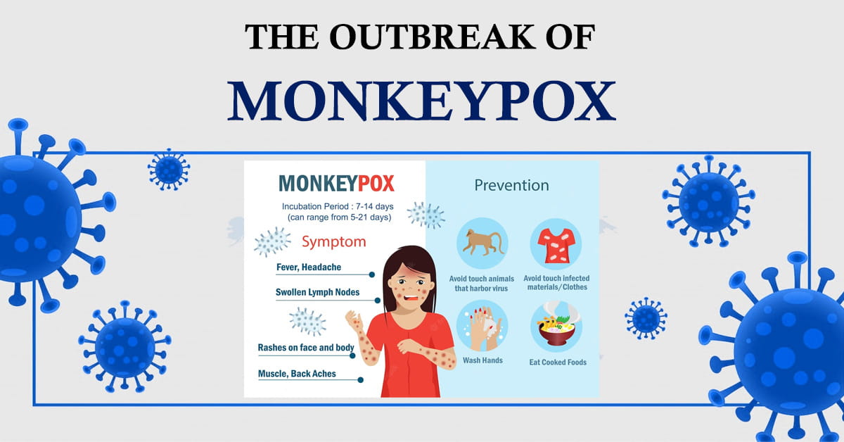 The Outbreak of Monkeypox