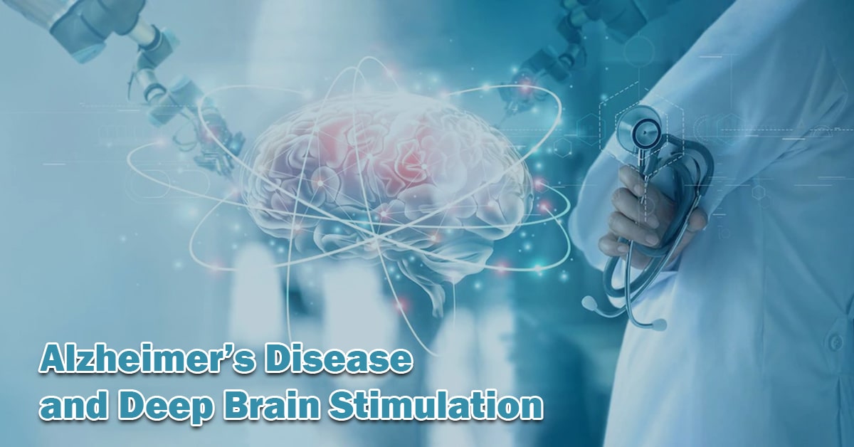 Alzheimer’s Disease and Deep Brain Stimulation