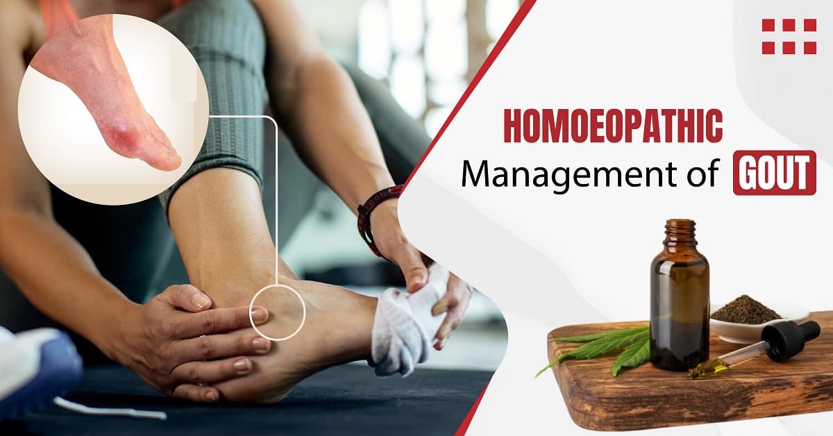 Homoeopathic Management of Gout