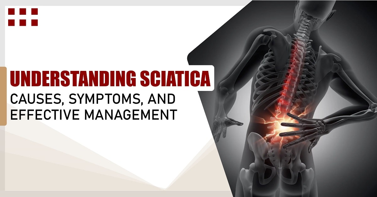Understanding Sciatica: Causes, Symptoms, and Effective Management