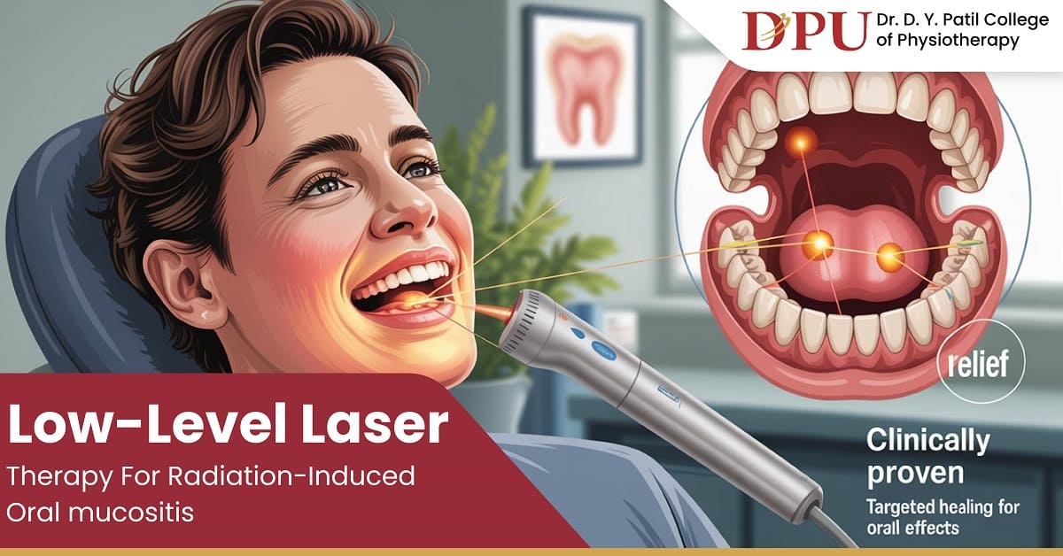 Low-Level Laser Therapy for Radiation-Induced Oral Mucositis