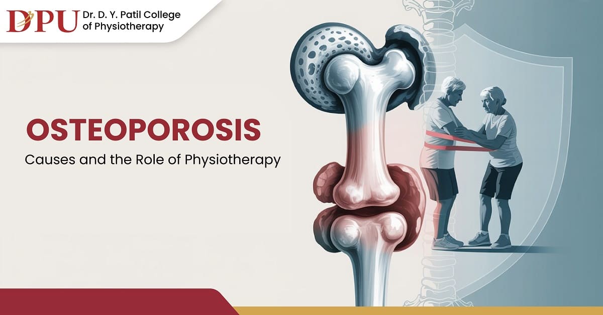Osteoporosis Uncovered: Causes, Prevention and Role of Physiotherapy