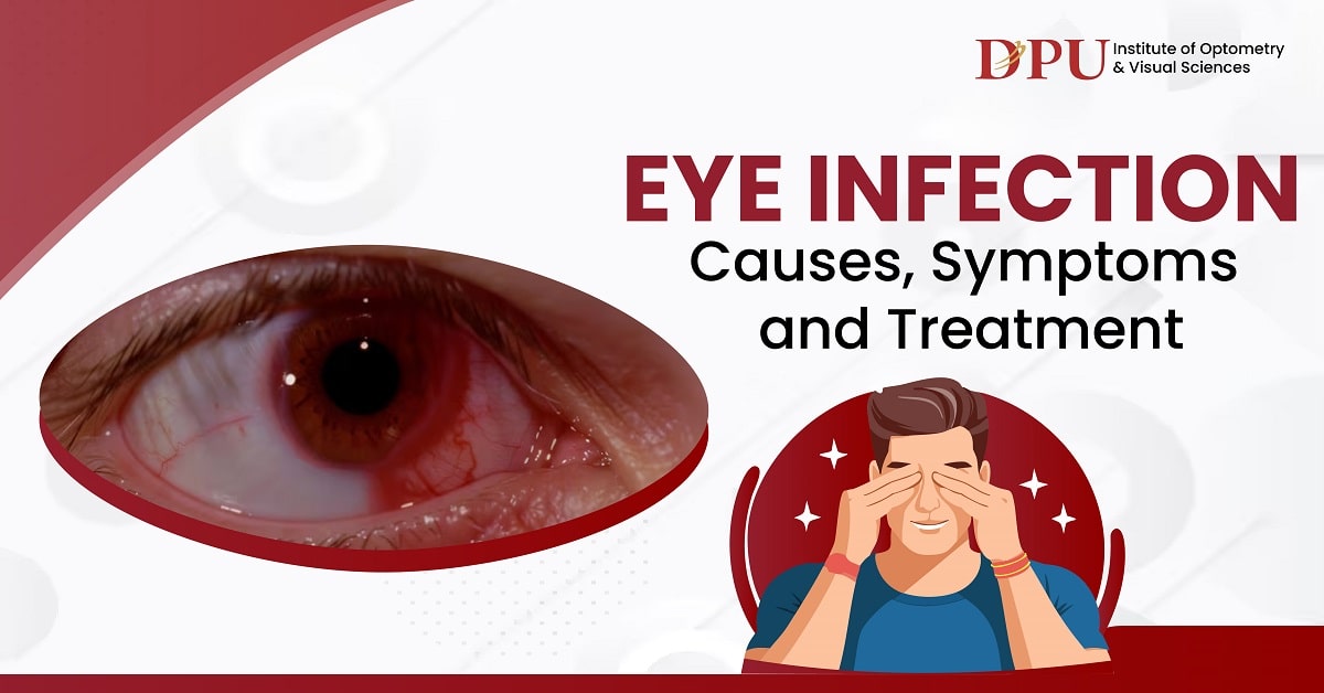 Eye Infection : Causes, Symptoms and Treatments