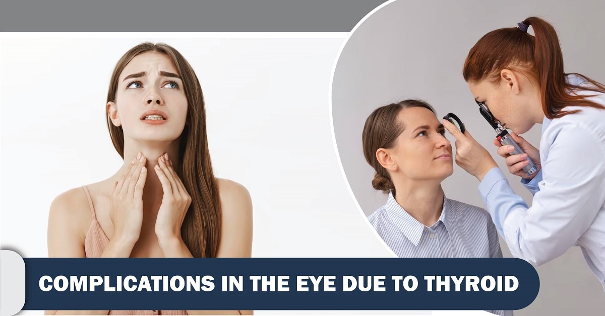 Complications in the Eye Due to Thyroid