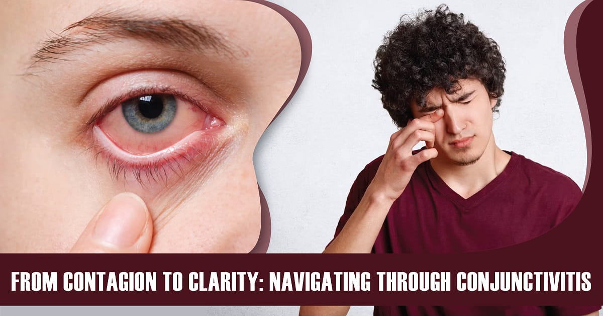 From Contagion to Clarity: Navigating Through Conjunctivitis