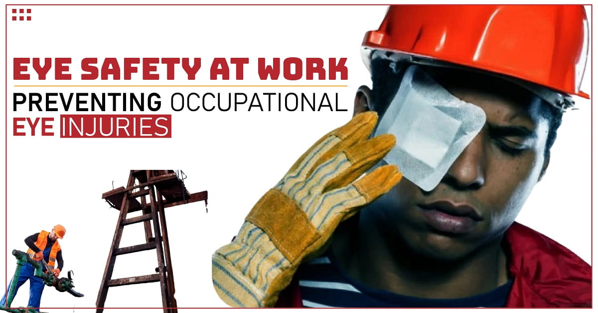 Eye Safety at Work: Preventing Occupational Eye Injuries